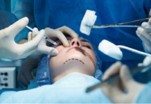 عمادة الأطباء: الطب التجميلي يظل نشاطًا طبيًا ويخضع لشروط الكفاءة والسلامة